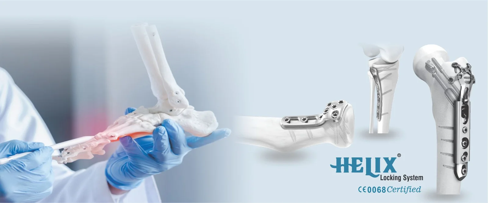 Orthopedic Implants Manufacturer in USA | Siora Surgicals